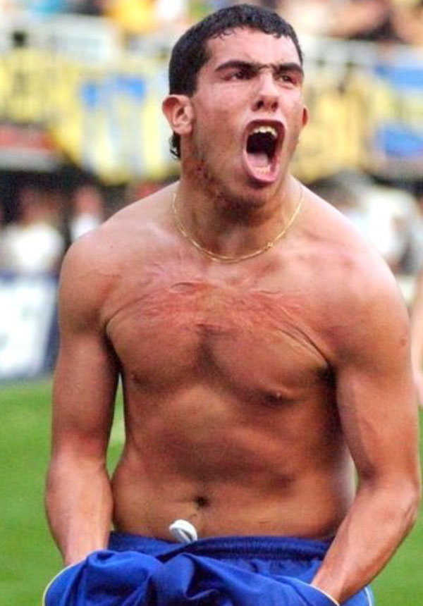 Футболист со шрамом от уха до груди заработал за каждый гол в Китае по 9,6 млн евро (фото) - «ФАКТЫ»